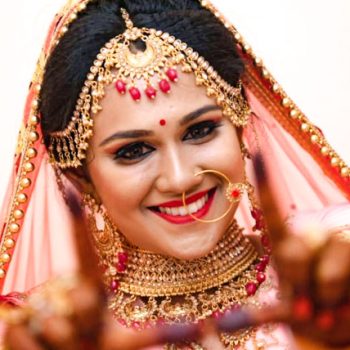 BridalSmileMakeover