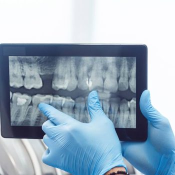 myDentalTX.com-9-Benefits-of-Digital-Dental-X-Rays