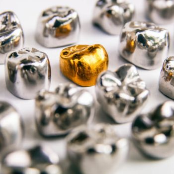 pros-and-cons-of-gold-metal-dental-crowns