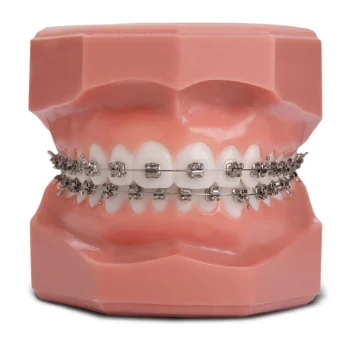 self-litigated-braces